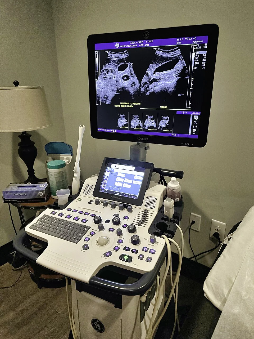 Ultrasound Systems